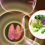 algas-marinas-coliflor-guisantes-y-auyama-contra-bocio